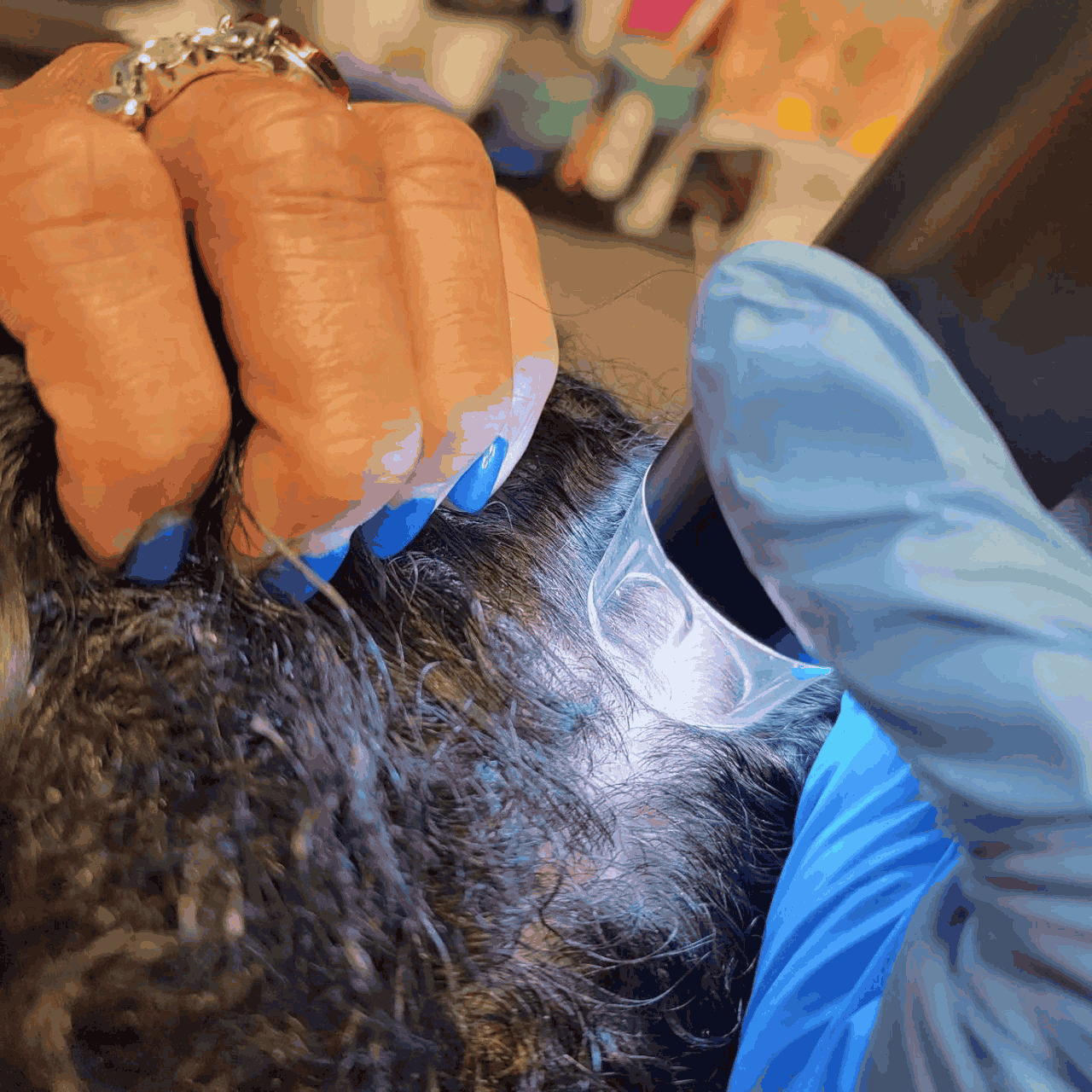 Gloved practitioner examining a client's scalp with a magnifying lens.